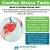 Cardiac Stress Tests