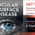 Ocular Surface Disease