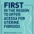 First in the Region to Offer Acessa for Uterine Fibroids